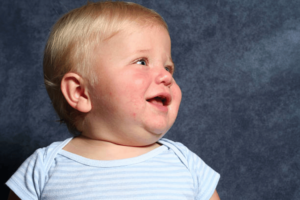 How To Identify, Treat, and Prevent Baby Drool Rash: Best Guid for new Parents